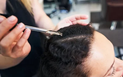 Effective Hair Regrowth Solutions in Houston TX